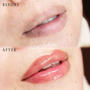 230301リップアートメイクShinePlus_BA_1080_1080_02