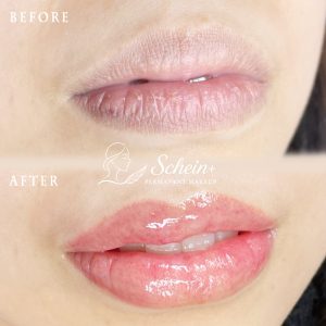 230305リップアートメイクShinePlus_BA_1080_1080